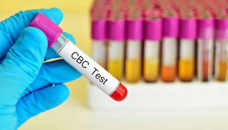 Which routine test measures the number of red and white blood cells?