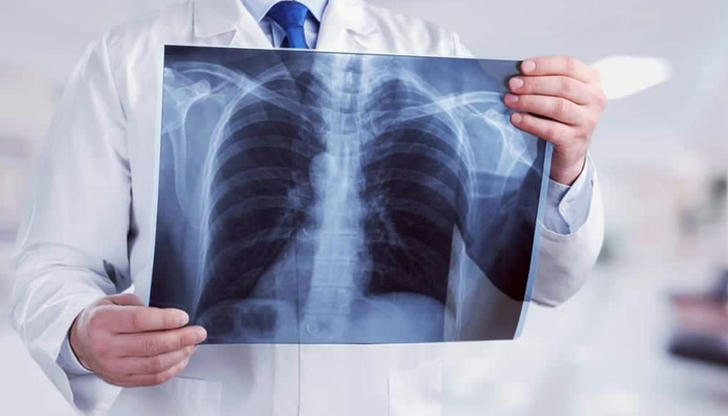 Which imaging method is most commonly used to detect bone fractures?