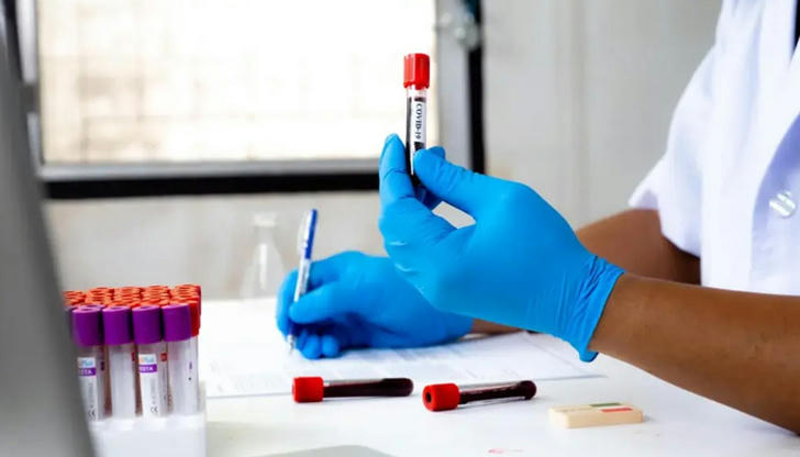 A fasting blood test usually requires what before the test?