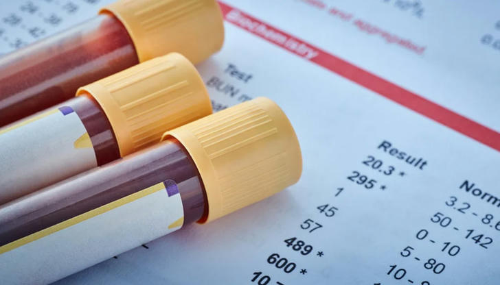 What does a blood test commonly measure?