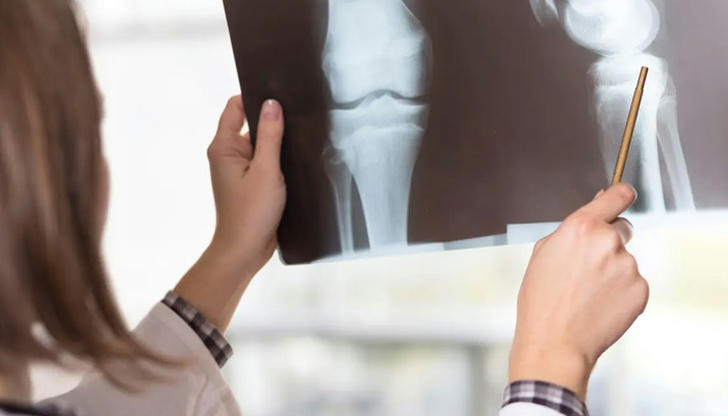 What is an X-ray mainly used for?