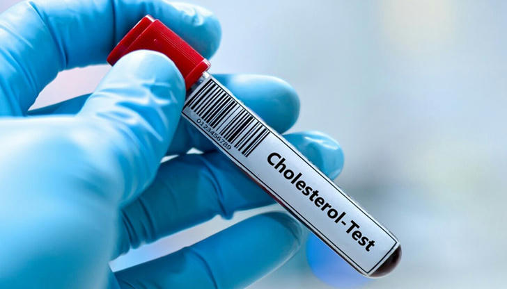 What does a cholesterol test check?
