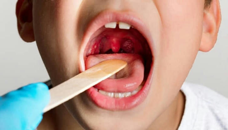 What does the suffix '-itis' usually mean in medical terms?