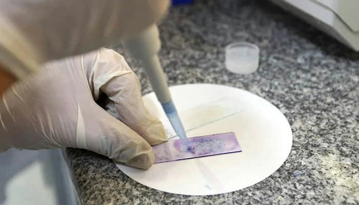 What’s a 'biopsy' used to find?