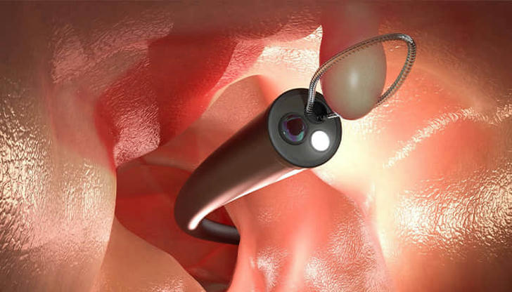 What procedure is commonly used to check the inside of the colon?