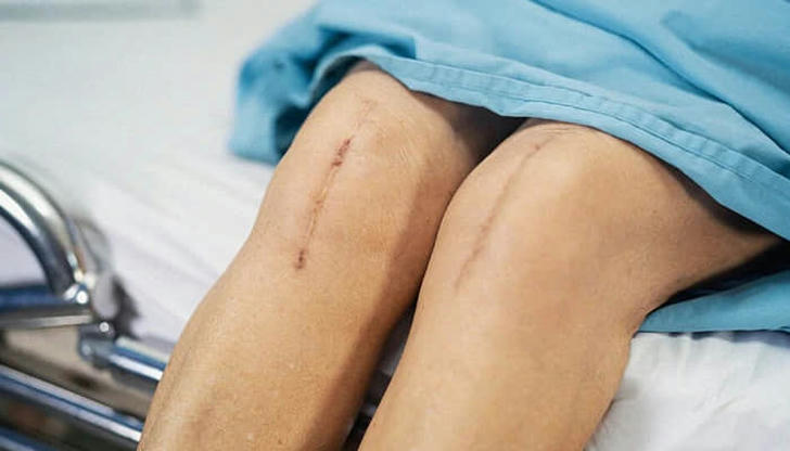 What is the term for surgically replacing or repairing a joint?